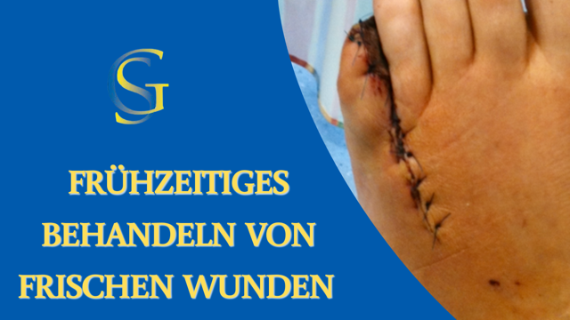 Wunden nach ein paar Tagen behandeln - Schneidermethode Wunden nach ein paar Tagen behandeln - Schneidermethode